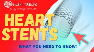 Download Coronary Stents: What you need to know!! MP3