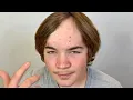His Sister Reached Out for HELP With Her Brother s Hair Is This FIXABLE