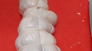 โรคซึมเศร้าคืออะไร และมีอาการอย่างไร