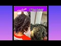 MicroLocs Interlock Technique