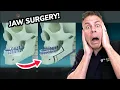 You Won t Believe What REALLY Happens In Jaw Surgery