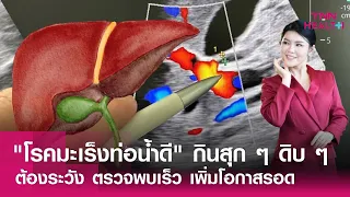 ควรทำอย่างไรเพื่อป้องกันโรคมะเร็งท่อน้ำดี