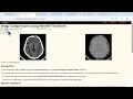 Interactive Biomedical Simulations Wavelet Compression Signal Noise Analysis