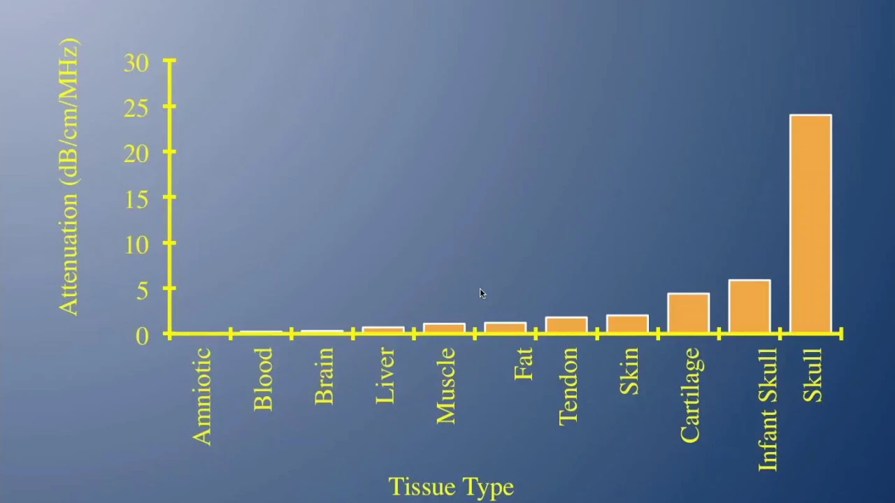 ATTENTION: ALARA is Important - An Update on the Bioeffects of Ultrasound