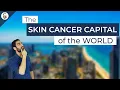 Do You Live In The Skin Cancer Capital Of The World Skin Types and UV exposure