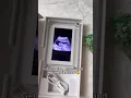 Download Lagu Link in bio to get your ultrasound frame