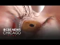 Millions of eye drops sold at CVS Walgreens recalled