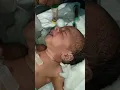 Download Lagu Just now baby birth being saction 😀👍 #youtubeshorts #newbornbaby #viral #shorts #video #nursing