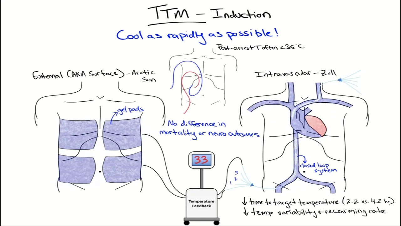 Chalk Talk: Targeted Temperature Management