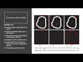V7 Feature Extraction 1 2 3 English With Voice 1