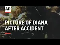 Download Lagu France - Picture of Diana after accident