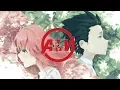 Download Lagu Koe no Katachi | In My Head | AMV ft. Peter Manos