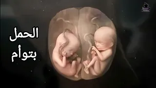 كيف يحدث الحمل بتوأم و اهم 4 طرق للحمل بتوأم وعلاقته بتنشيط التبويض دروس طبية 