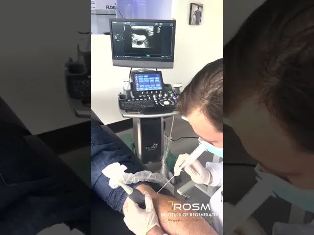 Where to Treat Baker Cyst in Fort Lauderdale | Dr. Jorge Gonzalez, IROSM