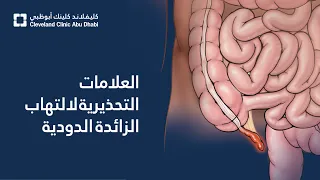 العلامات التحذيرية لالتهاب الزائدة الدودية دندنها