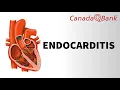 Download Lagu Endocarditis