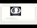 8 Preprocessing in Python Part 2