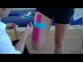 How to apply Kinesiology Taping for a strain of the Rectus Femoris Quadricep muscle strain