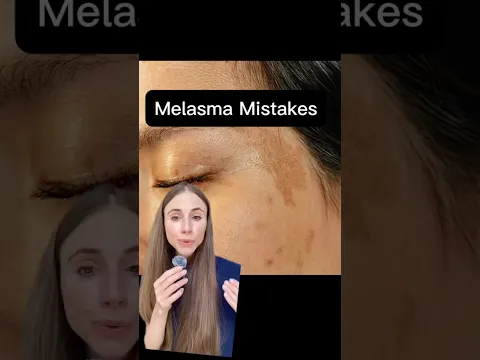 3 Melasma Mistakes Making It Worse