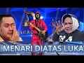 Download Lagu LEBIH BAIK PUTIH TULANG😭😭 || MENARI DIATAS LUKA - IMAM S ARIFIN