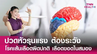 การวินิจฉัยโรคเส้นเลือดผิดปกติในสมองทำอย่างไร