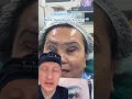 Shocking Black Swan Eye Surgery Trend Plastic Surgeon Reacts