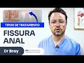 Fissura Anal - Conheca os tipos de tratamento