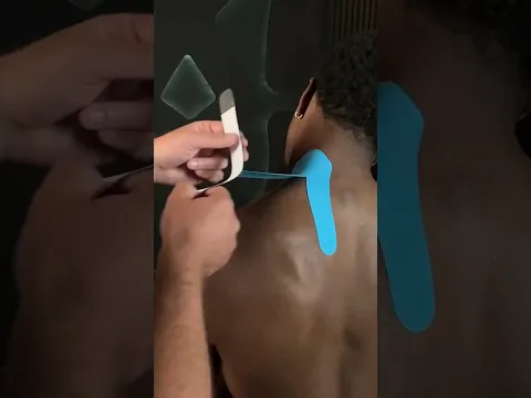 Taping For Upper Trapezius.