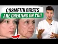 Download Lagu FACE REJUVENATION IN ONE WEEK is POSSIBLE! / How to lift the FACE CONTOUR at home?