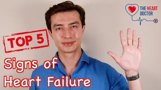 أهم   علامات تشير إلى قصور القلب دندنها