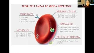 Anemias Hemolíticas