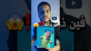 أغرب حاله نجاة بلا ذراعين Shorts 