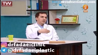 علت ایجاد خط خنده و روش از بین بردن آن 