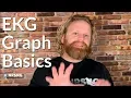 Basics of the EKG ECG Graph Explained