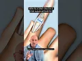 Silicone Artificial Joint Relieves Arthritis Pain