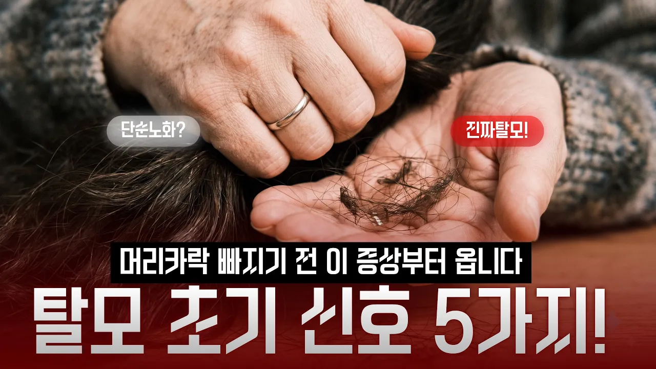 혹시 나도 탈모일까? 집에서 10초 만에 확인하는 5가지 탈모 자가진단법!