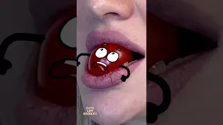 Cute Life Doodles Teeth Ate A Tomato Shorts Doodles Animations Doodlesart Doodle Reallifedo 