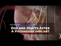 Dos and Don ts After A Pacemaker Implant