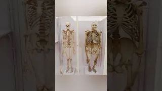 هيكل عظمي للإنسان بجانب هيكل عظمي للغوريلا الإختلاف الواضح نجده في الجمجمة دندنها
