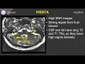 Technique on MRI - Inner Ear MRI