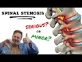 Is Spinal Stenosis serious The Clinic Episode 1