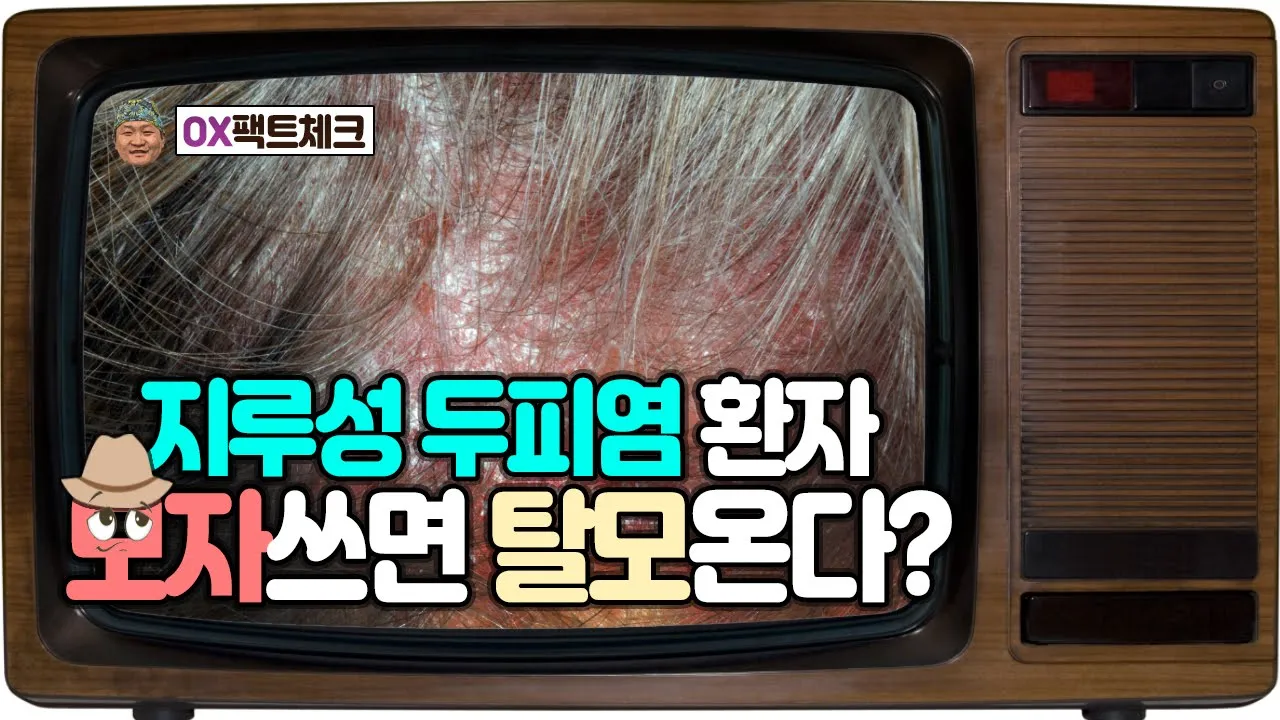 지루성 두피염, 모자쓰면 탈모올까요ㅠㅠ? [OX 16회]