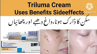 Tri luma Cream uses in Urdu l benefits sideeffects in Urdu