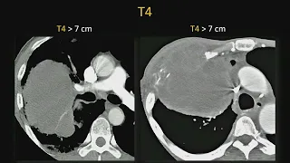 Radiology Case Review Cardiothoracic Imaging - Sample