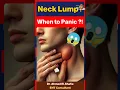 Neck Lump Warning Signs