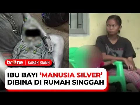 Miris, Bayi Diajak Mengamen dan Dicat Layaknya âManusia Silverâ