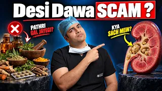 Kidney Stone Desi Dawa Scam Exposed! | पथरी की देसी दवा का खौफनाक सच | Cure Stone