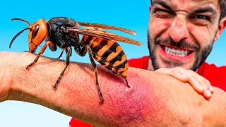‼️La PEOR Avispa‼️ Picado por Avispón Asiático - Peores Picaduras #24