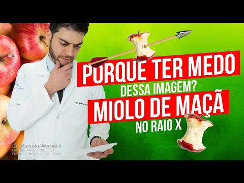 Download MP3 Porque ter medo dessa imagem? Miolo de maçã no raio X