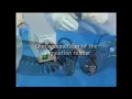 Olympus Bronchoscope Reprocessing